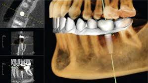 3D imaging example